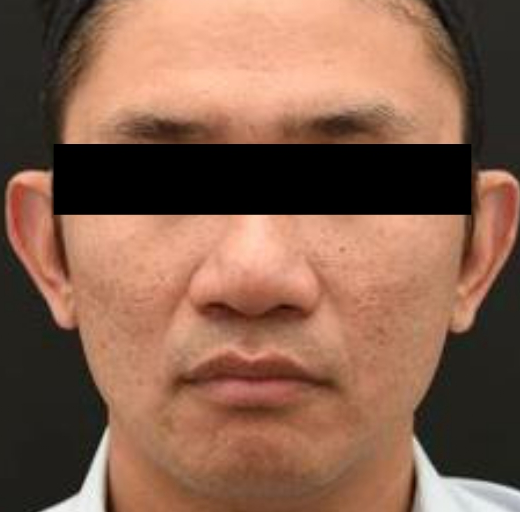 Before/After Image
